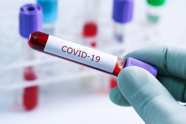 اجرای نخستین آزمایشات بالینی واکسن کووید-19 در کانادا