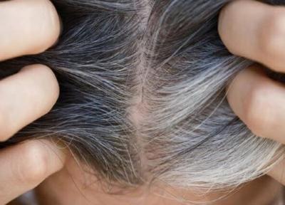 کشف راهی برای جلوگیری از سفید شدن مو ها